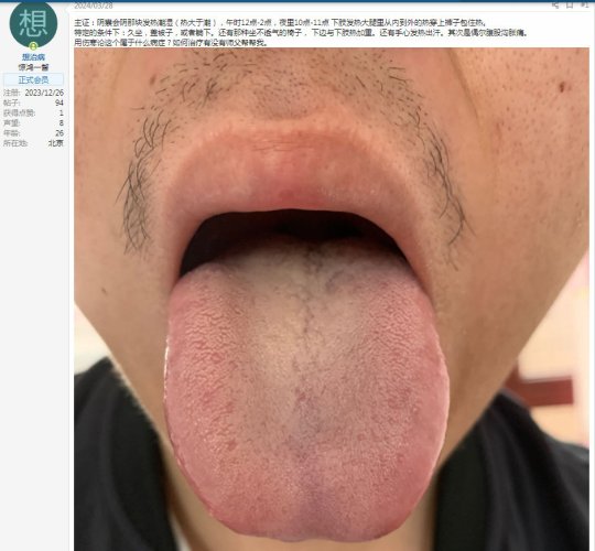 舌尖和舌根都有暗红的瘀斑（上焦和下焦都有血瘀）.jpg