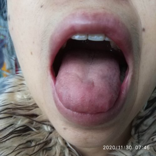 妈妈的舌头照片-20201130-3.jpg