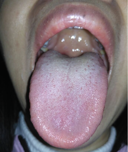 舌头.png